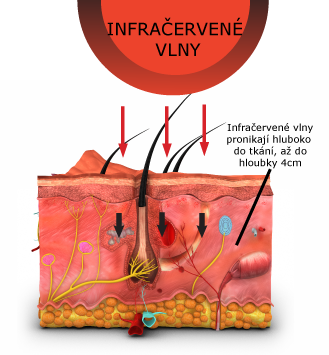 Působení infračervených vln